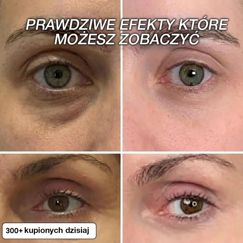 Sztyft Wypełniający z Biokolagenem i PDRN