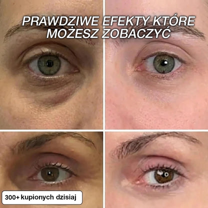 Sztyft Wypełniający z Biokolagenem i PDRN